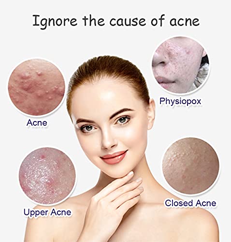 Aichun Beauty Anti Acne Face Serum 30ml