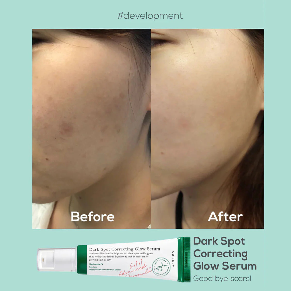 Axis-Y Dark Spot Correcting Glow Face Serum 50ml