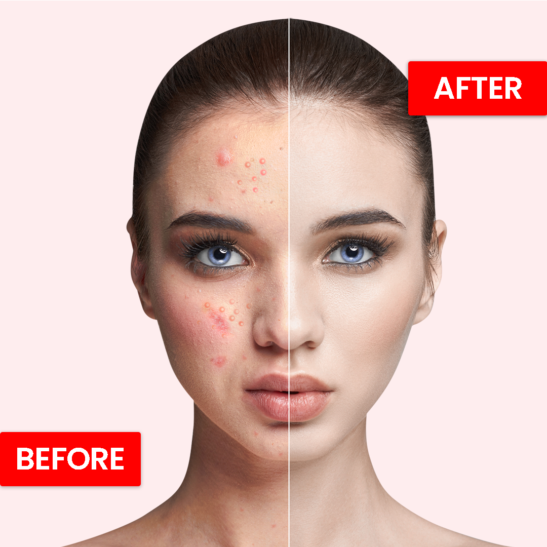 Face Fresh Gold Beauty Cream - Large