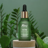 Rivaj Face Serum - Acne Treatment (30ml)
