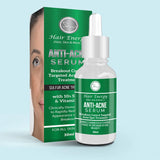Hair Energy Anti Acne Face Serum 30ml